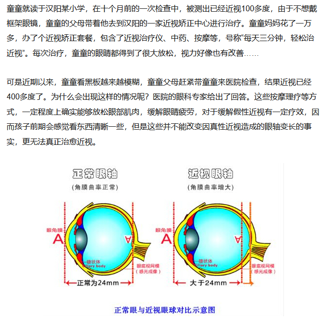 眼睛